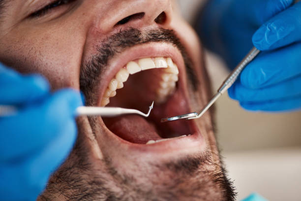 Best Emergency Treatment for Jaw Pain or Injury in Conesus Lake, NY